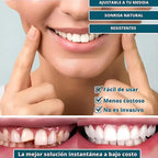 🔥 ¡COMPRA 1 Y RECIBE 2! SmilePro 🦷 - Carillas Dentales Ajustables De Resina + ESTUCHE REGALO - ¡Últimas unidades!