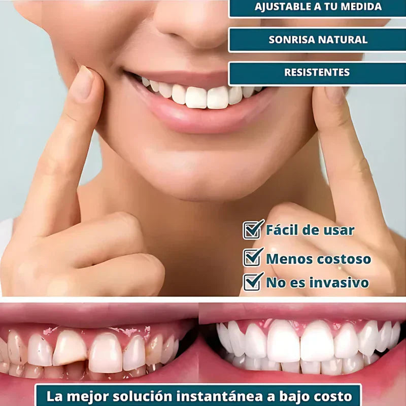 🔥 ¡COMPRA 1 Y RECIBE 2! SmilePro 🦷 - Carillas Dentales Ajustables De Resina + ESTUCHE REGALO - ¡Últimas unidades!
