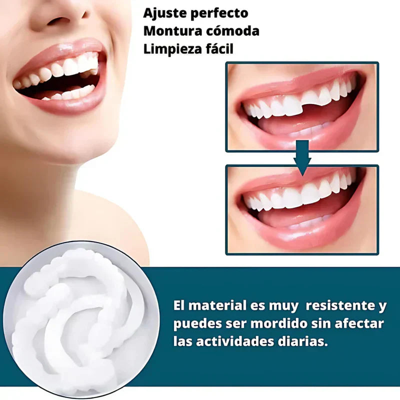 🔥 ¡COMPRA 1 Y RECIBE 2! SmilePro 🦷 - Carillas Dentales Ajustables De Resina + ESTUCHE REGALO - ¡Últimas unidades!