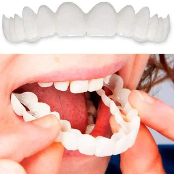 🔥 ¡COMPRA 1 Y RECIBE 2! SmilePro 🦷 - Carillas Dentales Ajustables De Resina + ESTUCHE REGALO - ¡Últimas unidades!