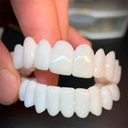 🔥 ¡COMPRA 1 Y RECIBE 2! SmilePro 🦷 - Carillas Dentales Ajustables De Resina + ESTUCHE REGALO - ¡Últimas unidades!